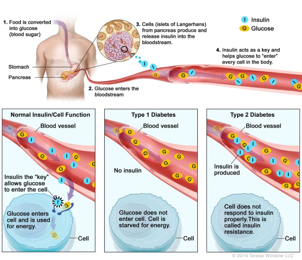 how to prevent diabetes,
how to prevent of diabetes,
what is diabetes,
healthy diet for prevent of diabetesk
diabetes prevention,
prevent type 2 diabetes naturally,
diabetes prevention lifestyle,
diabetes FAQs,