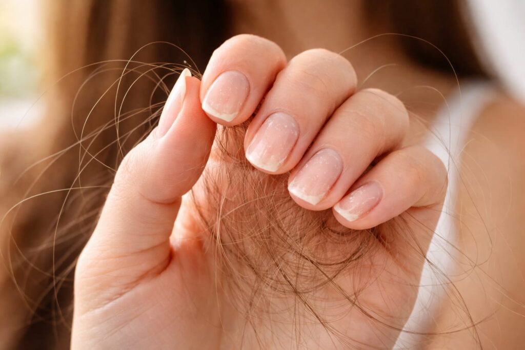 Biotin Supplements for Hair Loss